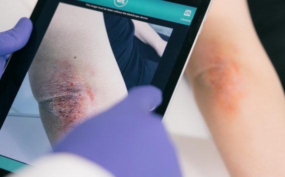 Teledermatologia a Delia: controlla la salute della tua pelle in farmacia